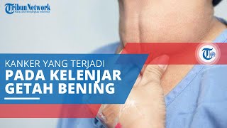 Limfoma Hodgkin, Kanker di Bagian Sistem Kekebalan Tubuh yang Disebut Sistem Limfatik