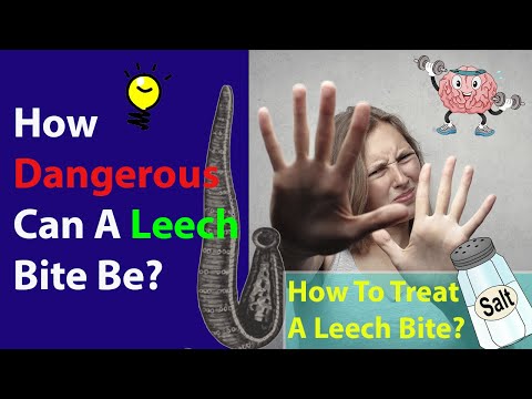 How Dangerous Can A Leech Bite Be?  | How To Treat A Leech Bite
