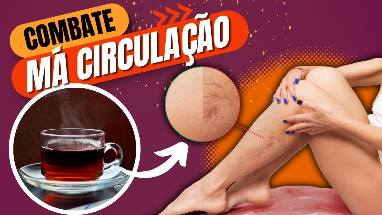 10 CHÁS INCRÍVEIS para MÁ CIRCULAÇÃO, VARIZES e DORES NAS PERNAS
