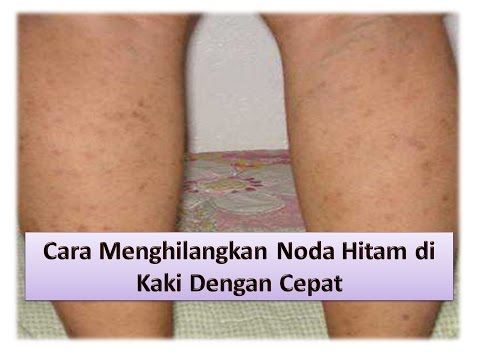Cara menghilangkan lemak dari sisi selama seminggu tanpa diet Coklat isyarat membeli makanan cair