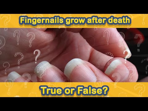 How SMART are YOU? Test yourself in True OR False Quiz No. 44