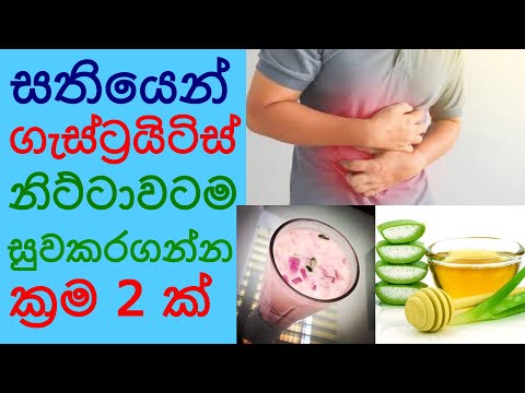 Gastritis ගැස්ට්‍රයිටිස් සුවකරගන්න ප්‍රත්‍යක්ෂ බෙහෙත සිංහල Gastik walata beheth - Sonduru Diviya