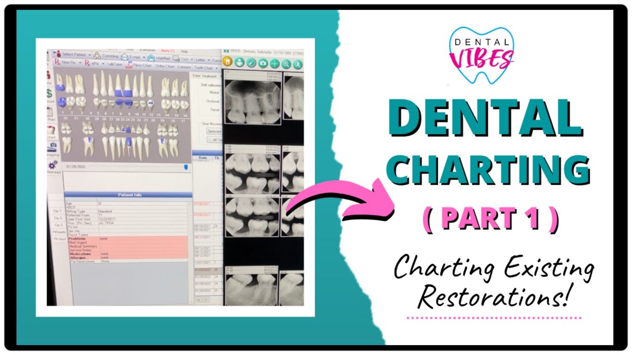 DENTAL CHARTING FOR DENTAL ASSISTANTS // PART 1 // Charting Existing Treatment