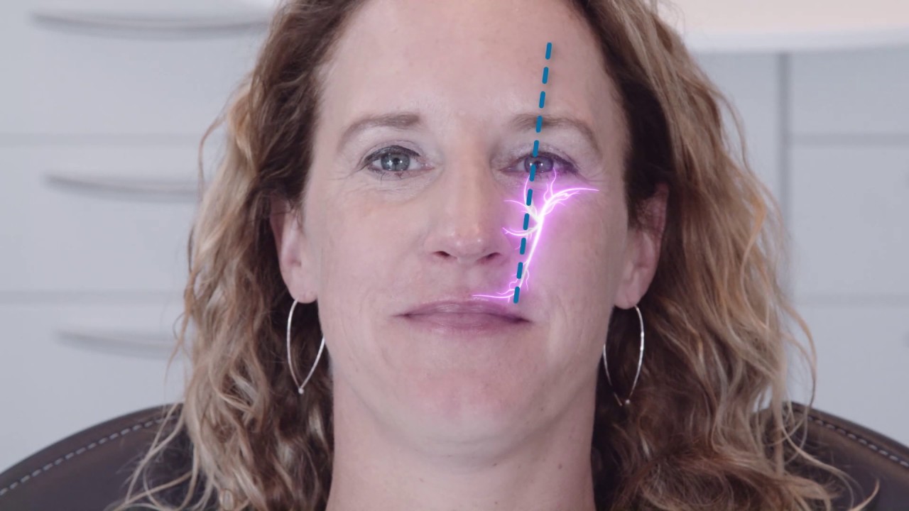 Maxillary Anesthesia Injection Techniques | Dentsply Sirona