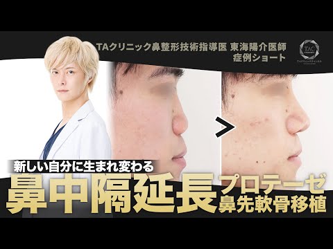 【TAクリニック】新しい自分に生まれ変わる鼻整形