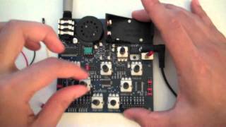 Video thumbnail for SuONOIO Overview by Surachai