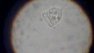 preview picture of video 'vorticella sp.'