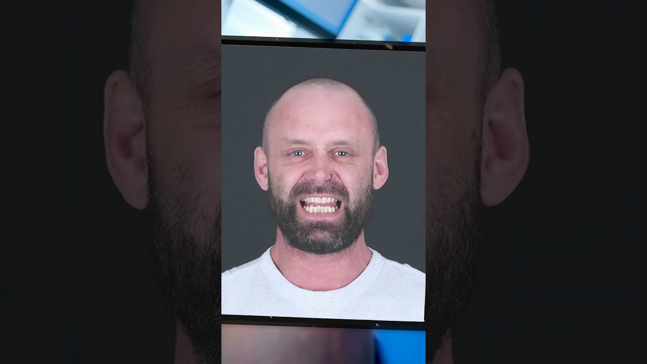 Временная корона - Video