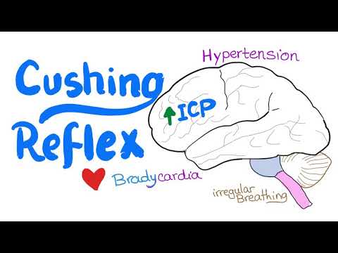 Cushing Reflex (intracranial hypertension)