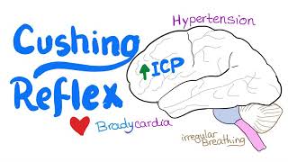 Cushing Reflex - Cushing Triad - Intracranial Hypertension - Emergency Medicine and EMS/ EMT