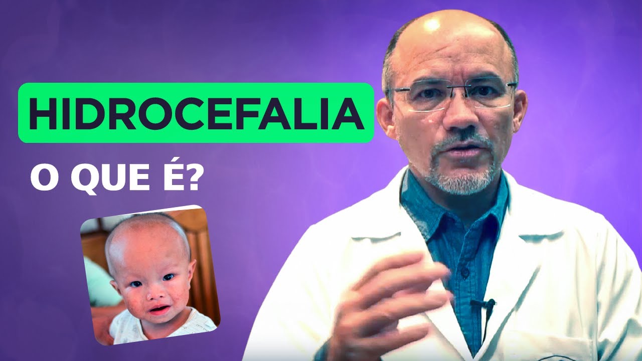 Neurocirurgião Explica! O que é a Hidrocefalia?