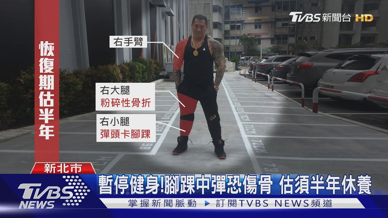 館長中槍復原良好　醫師：換藥還能開玩笑