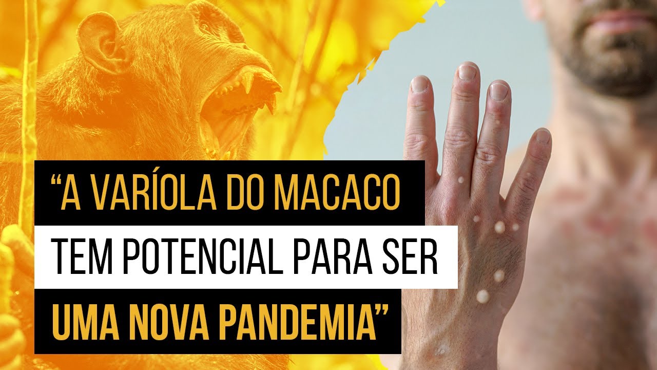 Varíola do macaco (MPox ou Monkeypox) - Como pega? (e tudo mais)