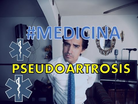 Quando il dolore alla schiena e nelladdome che possono essere in Ginecologia Trattamento osteocondrosi cervicale dei punti di agopuntura