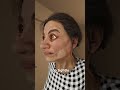 The Facelift That Left Her Eyes Stuck Open