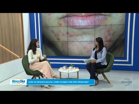 Acne da mulher adulta: Como acabar com esse problema? 19 01 2023