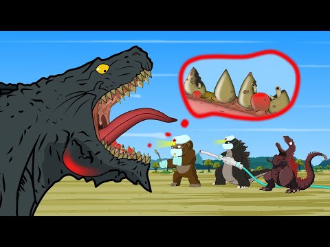 Rescue Tooth Godzilla: Save of A Tooth w/ A Very BIG and DEEP Cavity | Godzilla & KONG Cartoon FUNNY