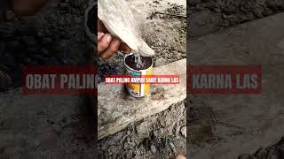 Download lagu Obat paling ampuh sakit mata karena las #viral #fypシ #welder #welding #belajarlas #shortsviral mp3