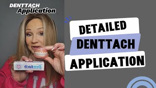 DETAILED DENTTACH APPLICATION - TOP AND BOTTOM DENTURE 🦷✨️