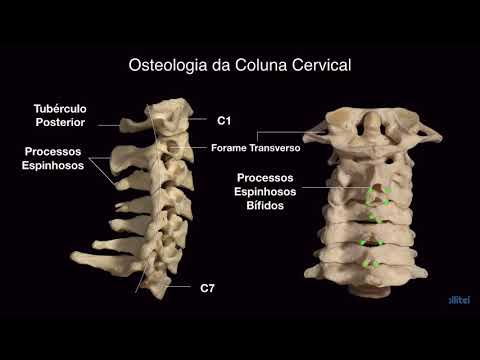 Polso blocco articolazione Osteocondrosi cervicale e ronzio nel trattamento orecchie