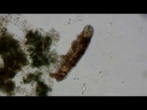 Tardigrades trying... water bears struggling to move
