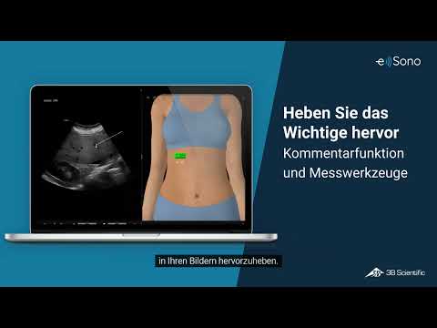 Entdecken Sie e Sono, den neuen Ultraschall-Software-Simulator von 3B Scientific