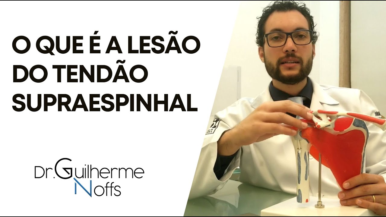 Lesão do Tendão Supraespinhal - Dr Guilherme Noffs