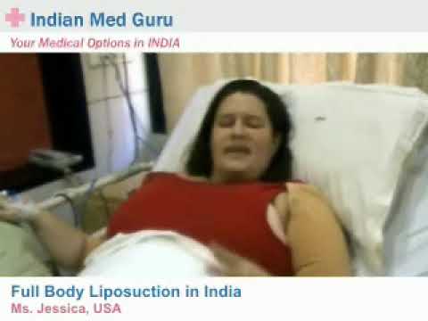 Foreign Patient for Cheap Full Body Liposuction at Hospitals Of Delhi in India