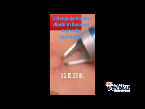 Video firme Estetic Anti Aging Medical Laser Centar