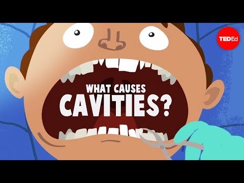 What causes cavities? - Mel Rosenberg