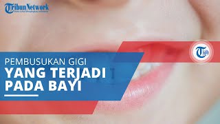 Baby Bottle Tooth Decay, Pembusukan Gigi pada Bayi karena Sering Menggunakan Dot atau Botol Bayi
