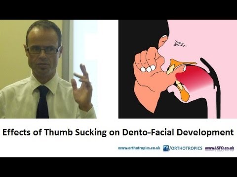 Effects of Thumb Sucking on Dento-Facial Development by Dr Mike Mew