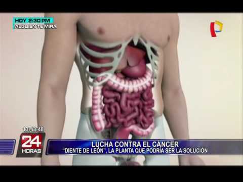download lagu mp3 mp4 Diente De Leon Contra El Cancer, download lagu Diente De Leon Contra El Cancer gratis, unduh video klip Diente De Leon Contra El Cancer