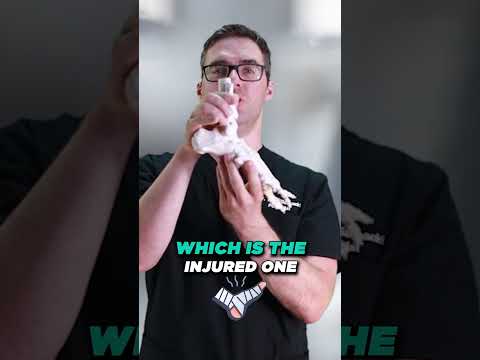 Broken Ankle or Sprained Ankle How to Know 2022 Doctor Guide