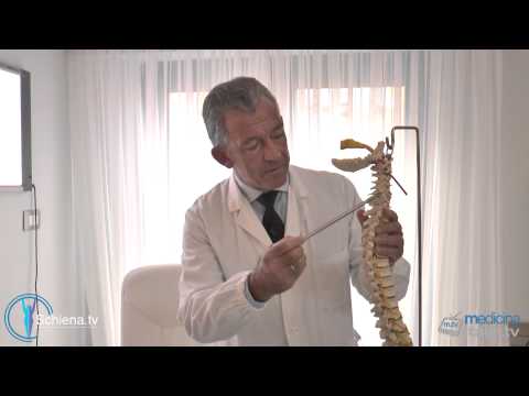 Vita e le gambe dopo il sollevamento pesi mal La sindrome astenico-nevrotica con osteocondrosi cervicale