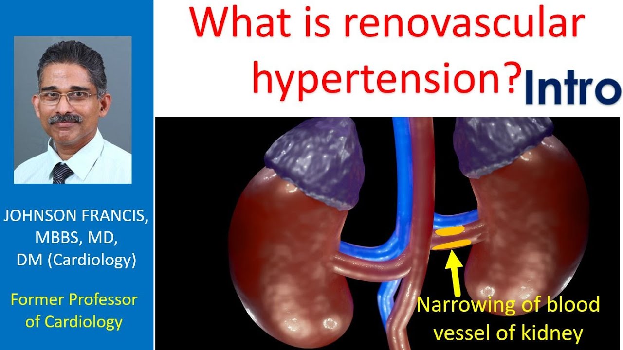 What is renovascular hypertension Intro