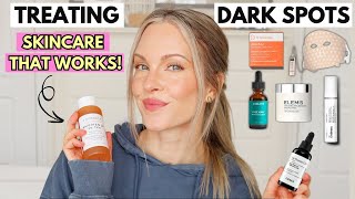HOW TO FADE DARK SPOTS QUICKLY - BEST SERUMS & TREATMENTS THAT REALLY WORK!