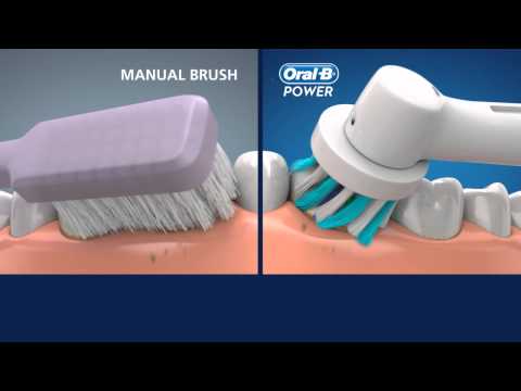 Oral-B CrossAction vs manual toothbrush