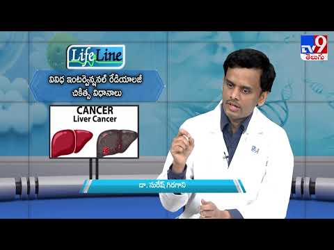 Various Interventional Radiology Treatment Procedures | Dr. Suresh Giragani