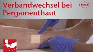 Schmerzfreier Verbandwechsel bei Pergamenthaut - Wundauflagen mit Silikon-Haftrand
