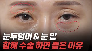 꺼진 눈두덩이, 칙칙한 눈 밑 한 번에 끝! ✨25년차 의사의 추천✨ 눈두덩이 지방이식&눈밑지방재배치 같이 해요