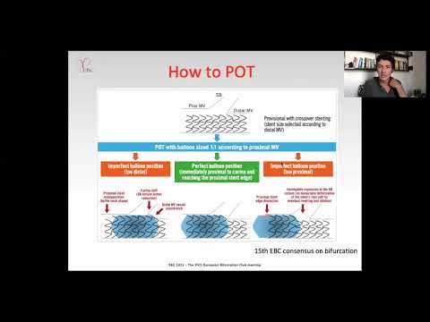 To POT or no to POT: Data from EBC Main - Dr Pietro Laforgia