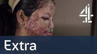 Acid Attack: The Girl Who Lost Her Face | Unreported World Shorts