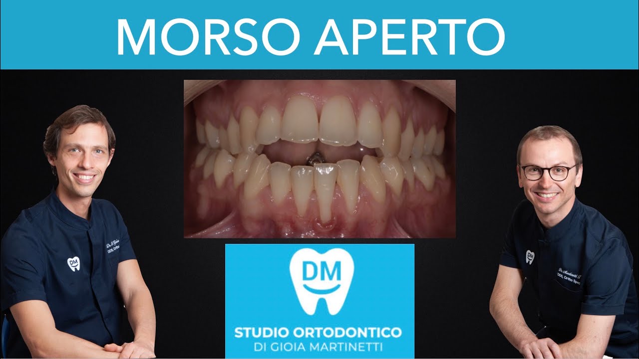 Francesco Martinetti-13