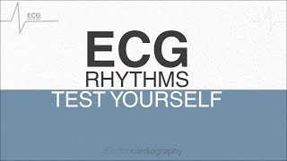 ECG Rhythms for self-assessment: Test ECG Interpretation Skills