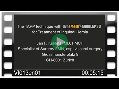 DynaMesh®-ENDOLAP 3D - OR-Video: The TAPP Technique for Treatment of Inguinal Hernia