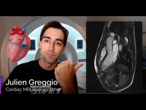 Cardiac MRI Planning - Full Guide (Part 1)