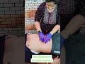 Navel Displacement And Acidity Treatment By Dr Deepanshi Chiropractor Short Video Viral