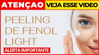 ? Peeling de fenol - peeling de fenol light - peeling químico - peeling para rejuvenescimento