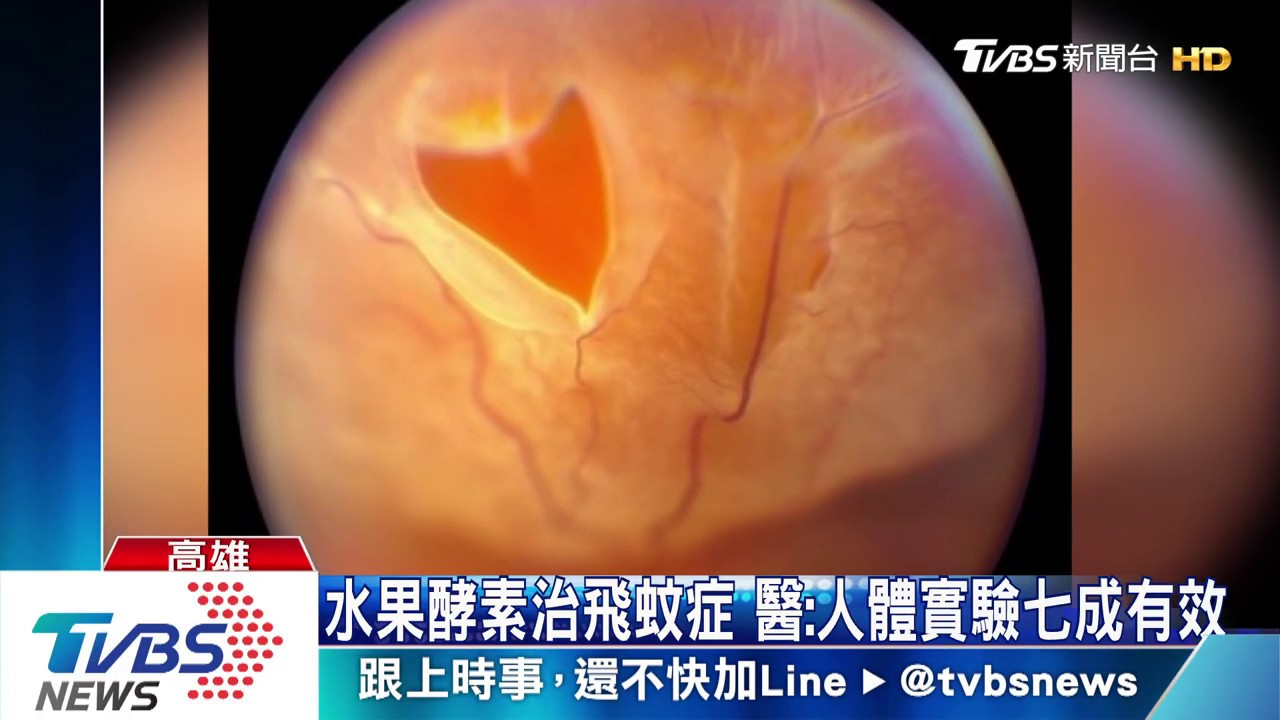 水果酵素治飛蚊症　醫：人體實驗七成有效